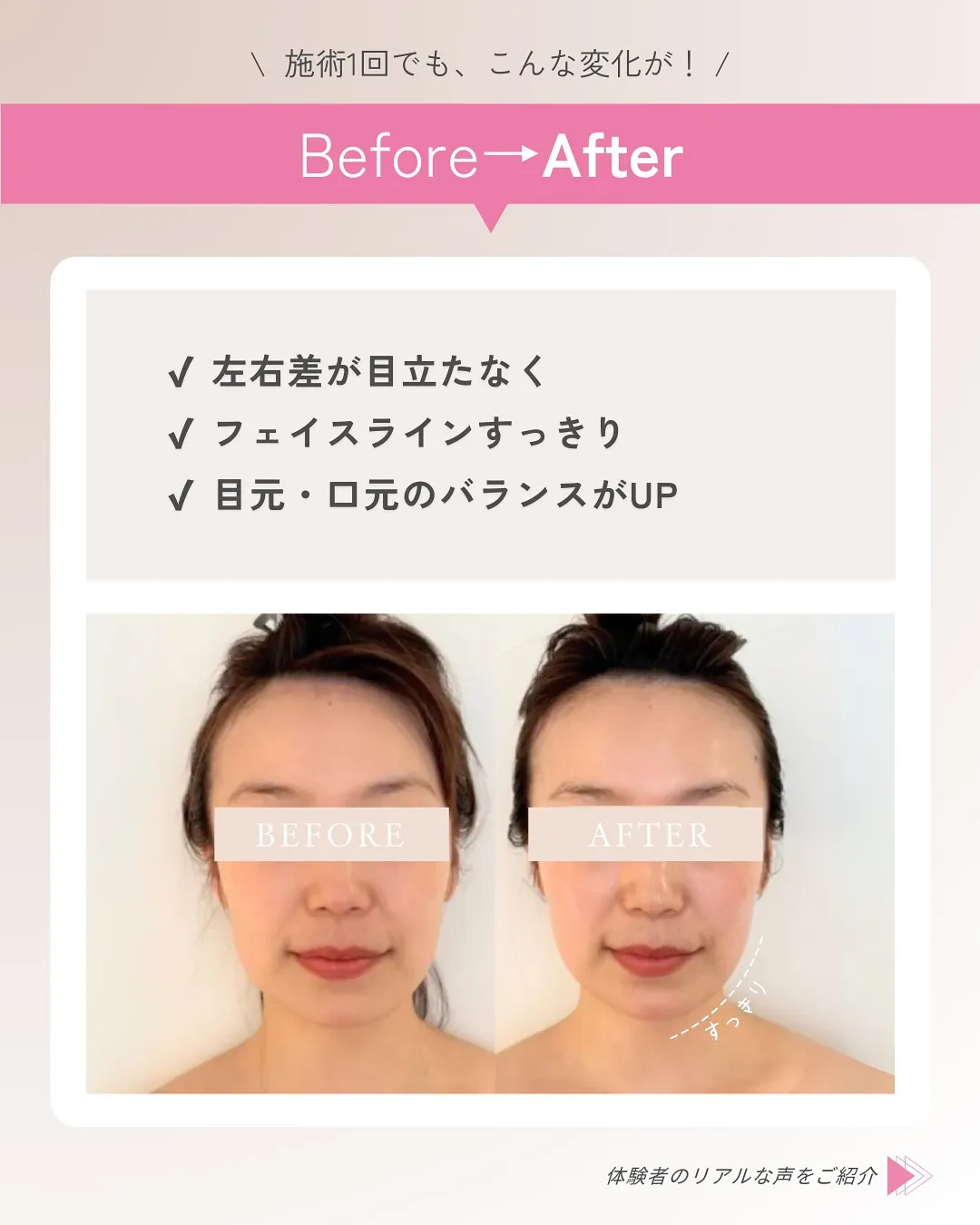 「顔の左右差、むくみ、なんだか疲れやすい…」