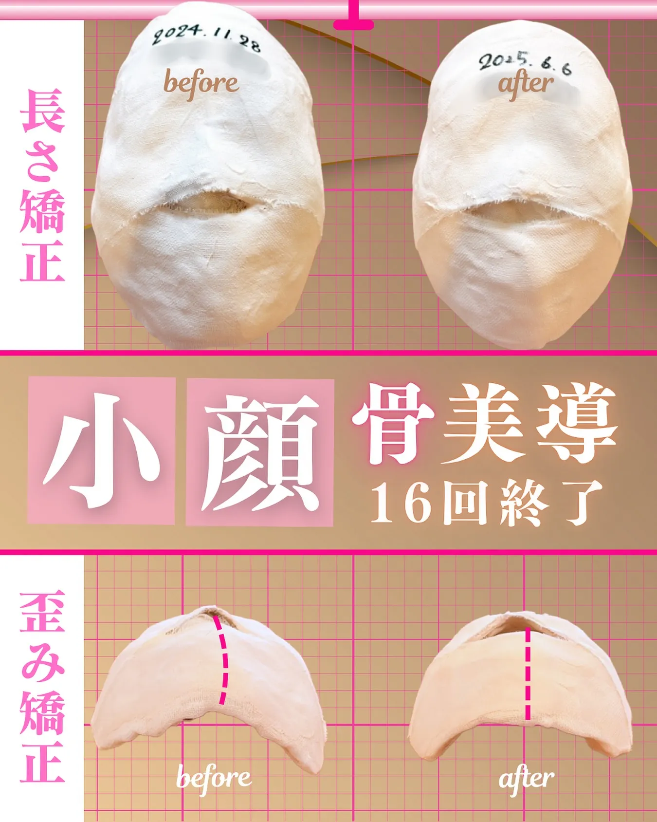 🌿 小顔骨美導60分・16回コース終了 🌿