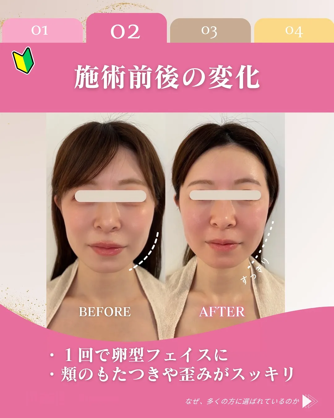 📘骨格矯正・コルギって痛いの？