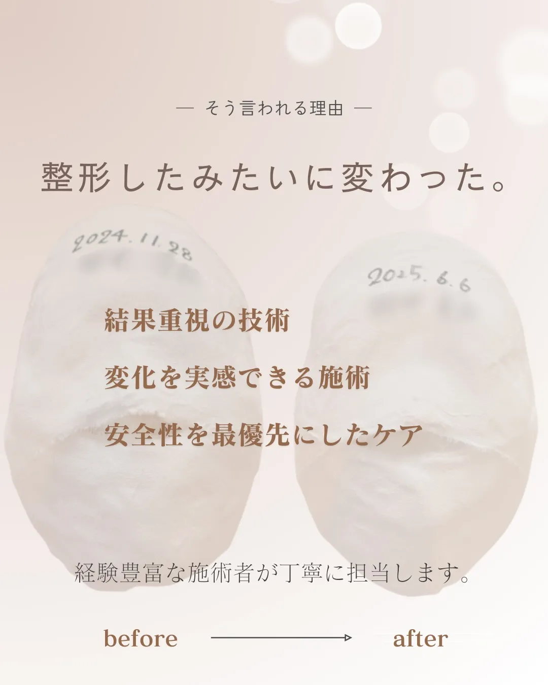 なりたい顔に、生まれ変わる。