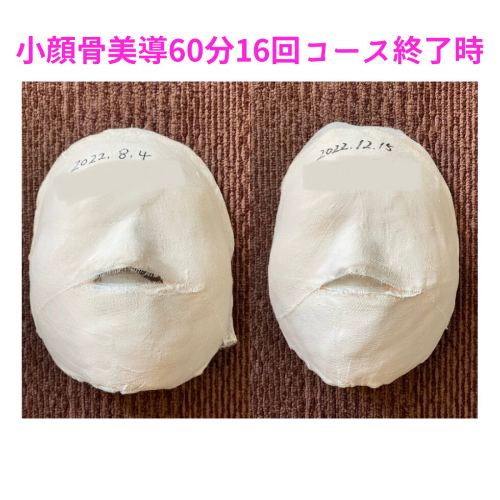 小顔骨美導60分16回BeforeAfter